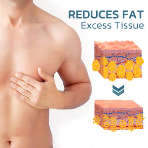 Gynecomastia kompressziós tank felső